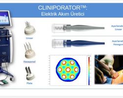 Elektrokemoterapi Nedir? Nasıl Uygulanır?