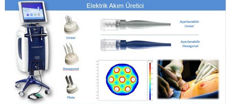 Elektrokemoterapi Nedir? Nasıl Uygulanır?